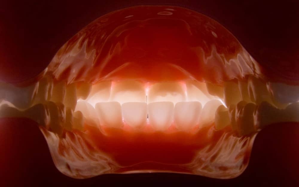 good-vs-bad-species-of-bacteria-oral-microbiome-Bradford-Dentist