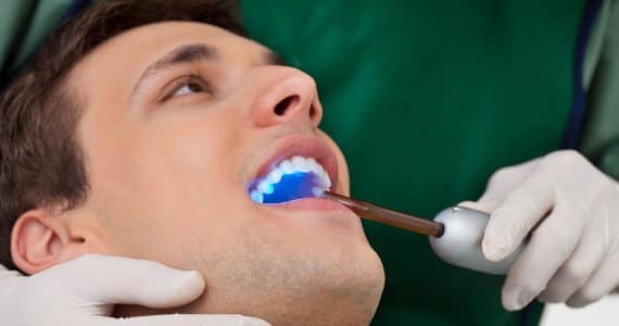 Dental Bonding Treatment