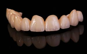 crowns-veneers-diy-teeth-whitening-Bradford-Dentist