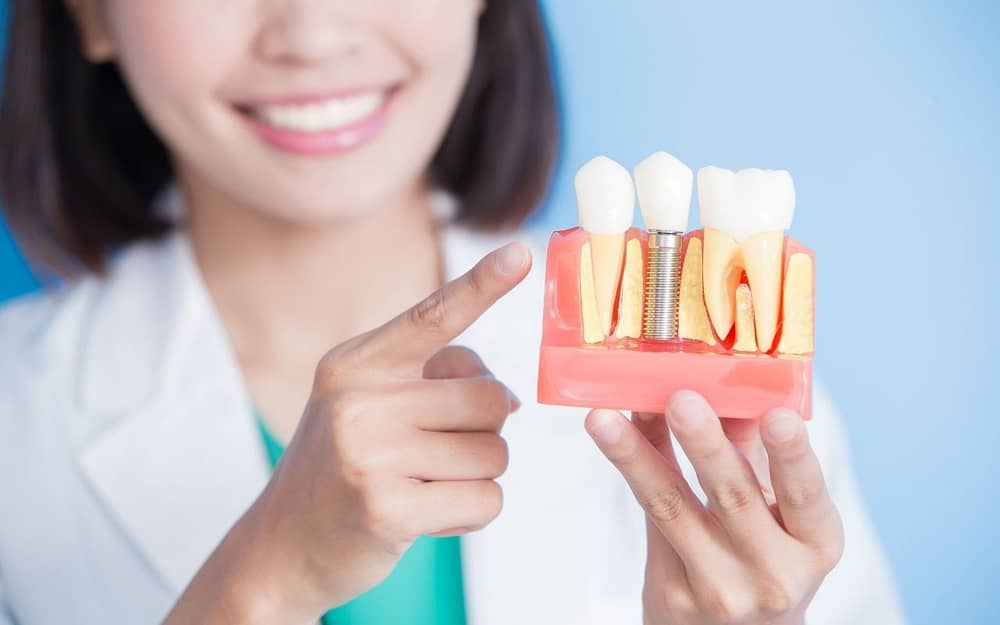 dental-implants-star-wars-day-cosmetic-dentistry-Bradford-Dentist