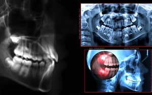 Digital-Radiography-Latest-Technology-in-Dental-Care-Bradford-Dentist
