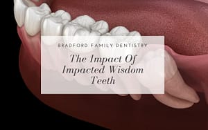 the-impact-of-impacted-wisdom-teeth-Bradford-Family-Dentistry