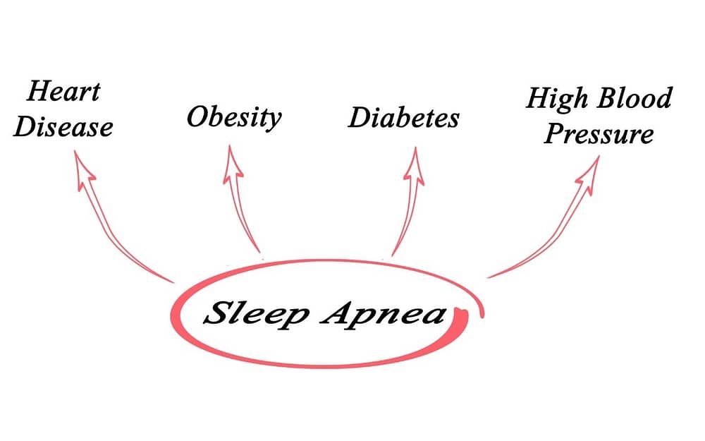 health-risks-associated-with-sleep-apnea