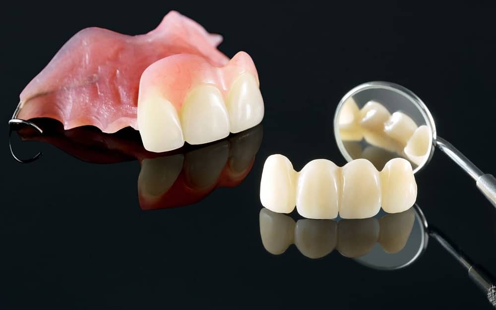 temporary-dentures