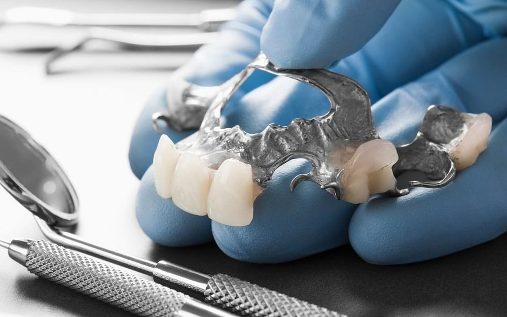 dental-bridge-Bradford-Dentist