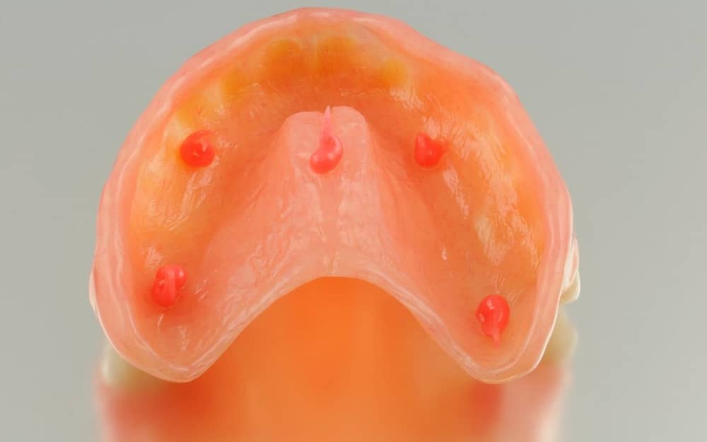 shifting-dentures-use-good-adhesive-Bradford-Dentist
