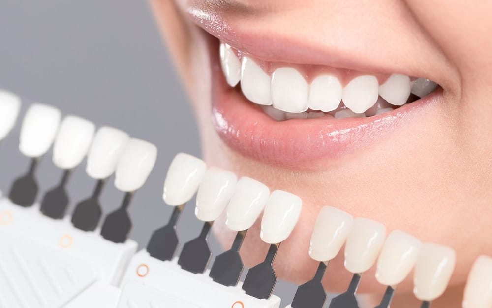 teeth-whitening-star-wars-day-Bradford-Dentist