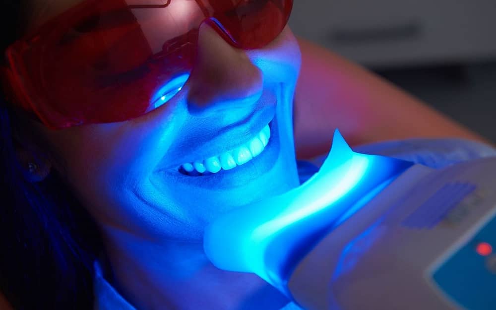 comfortable-teeth-whitening-modern-dentistry