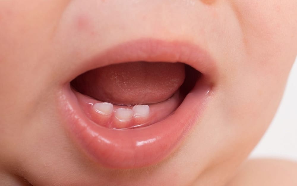 when-should-baby-receive-dental-care-Bradford-Family-Dentistry