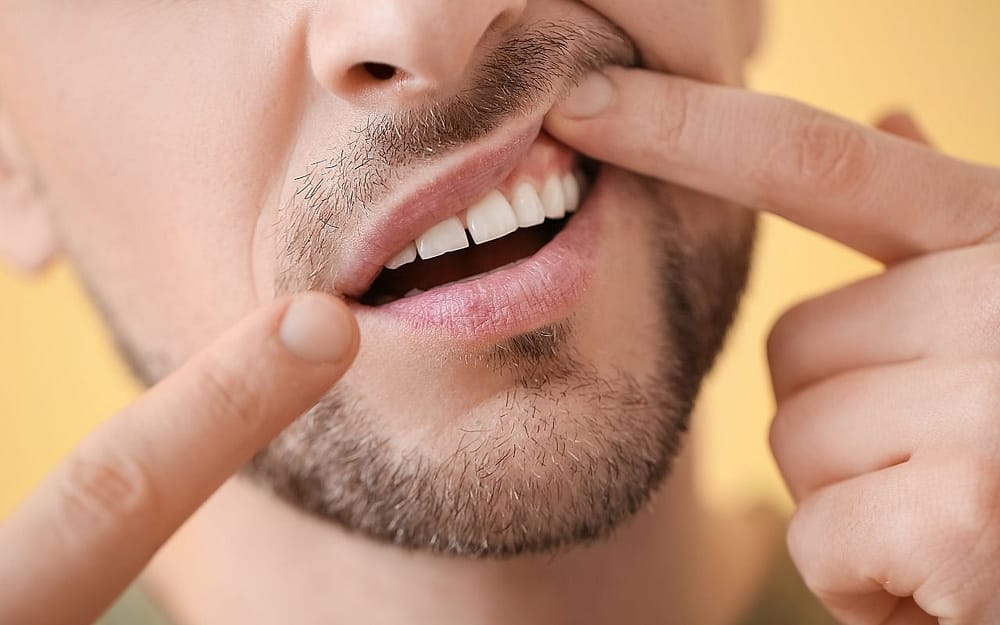 gum-disease-most-common-dental-problems-Bradford-Dentist