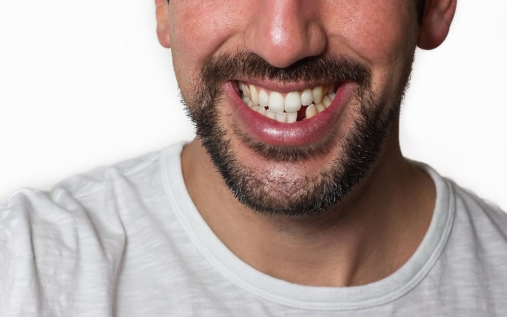 importance-of-replacing-missing-teeth-questions-about-dental-implants
