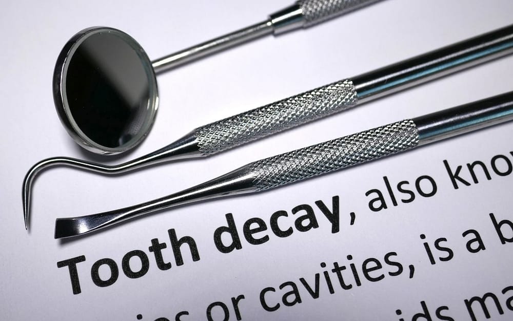 tooth-decay-is-common-childhood-dental-problem-Bradford-Dentist