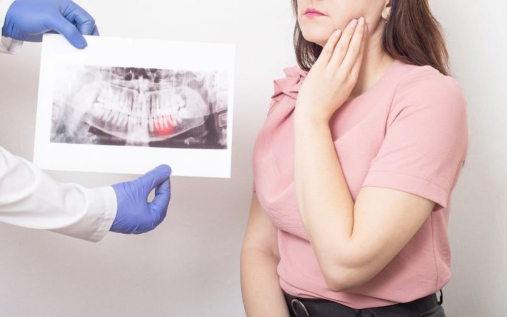 why-are-impacted-wisdom-teeth-extracted-Bradford-Dentistry