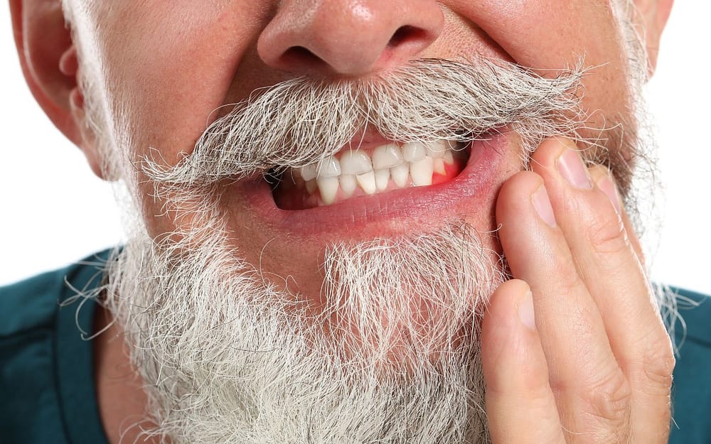 crooked-teeth-cause-more-wear-and-tear-on-teeth