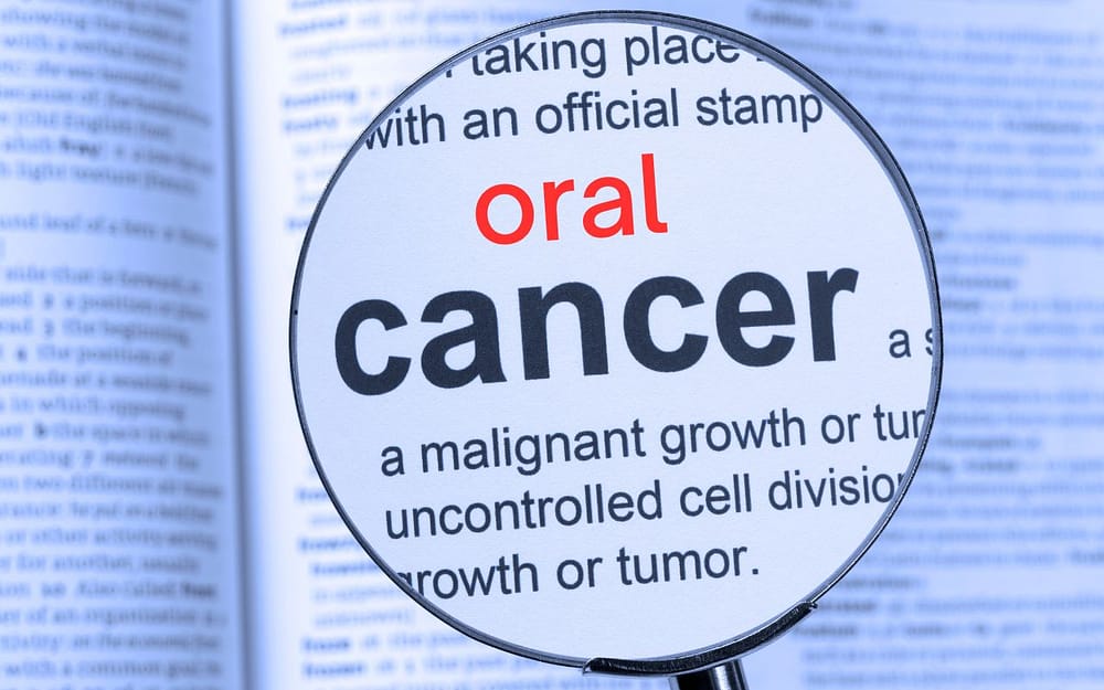 what-is-oral-cancer