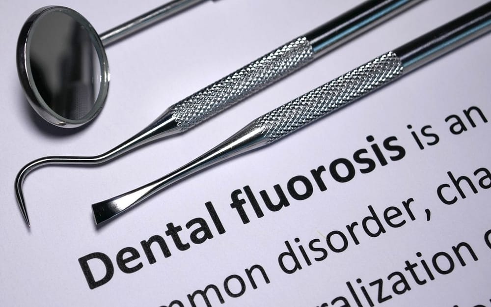 too-much-fluoride-leads-to-dental-fluorosis