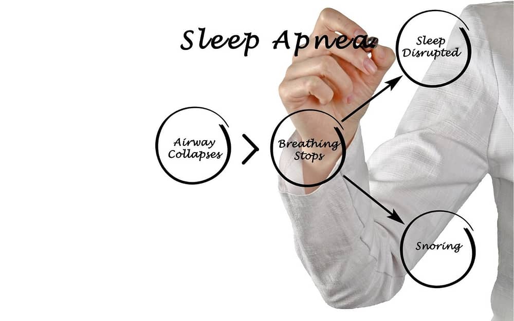 symptoms-of-sleep-apnea-loud-snoring