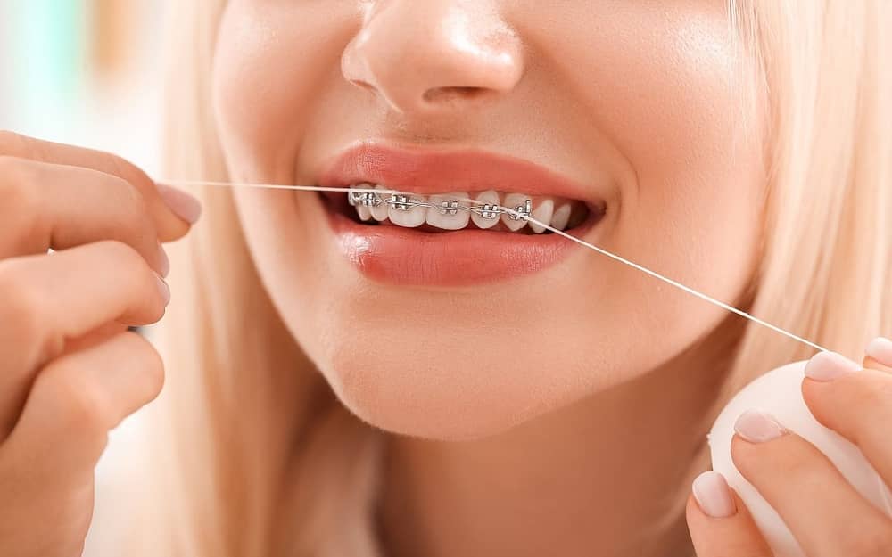 how-to-floss-with-braces-Bradford-Family-Dentistry