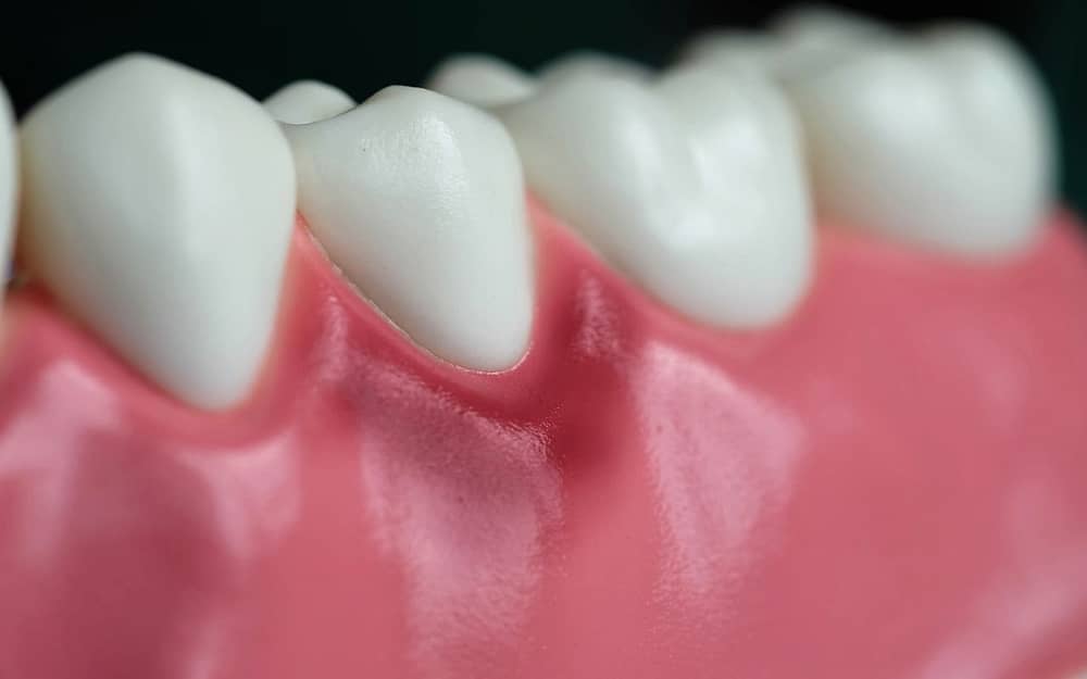 what-causes-gums-to-bleed-Bradford-Dentist