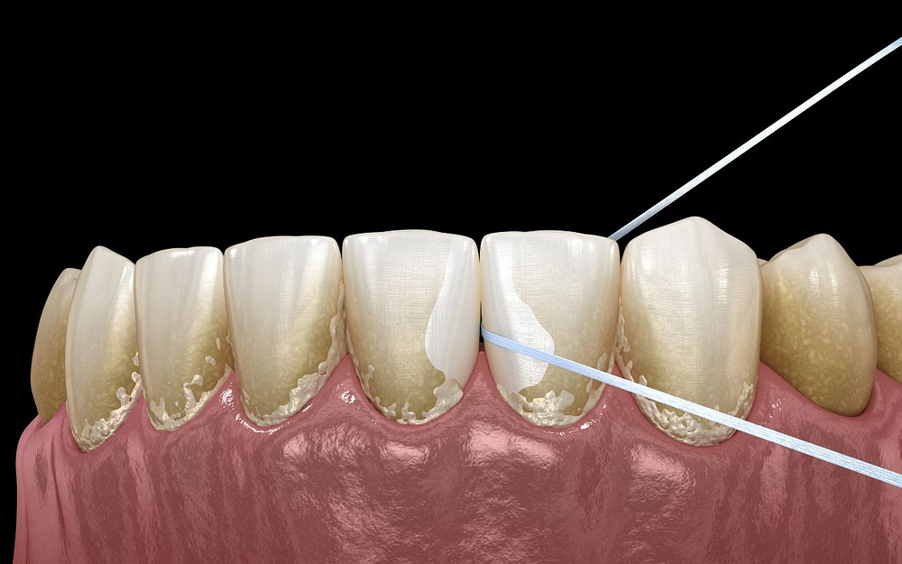 how-to-use-dental-floss-dental-floss-explained