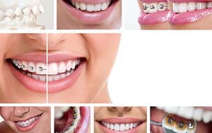 Bradford-Orthodontics-with-PayBright-Bradford-Family-Dental