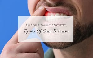 types-of-gum-disease-Bradford-Family-Dentistry