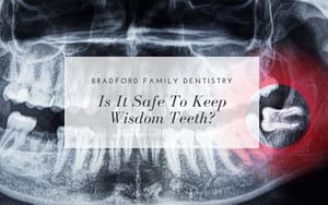 is-it-safe-to-keep-wisdom-teeth-Bradford-Family-Dentistry