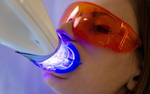professional-teeth-whitening-Bradford-Family-Dentistry