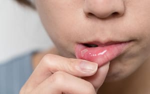 A woman is putting her finger on her lips, indicating common childhood dental problems.