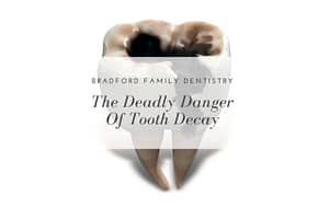 the-deadly-danger-of-tooth-decay-Bradford-Family-Dentistry