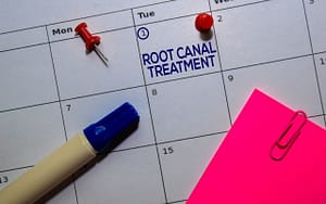 A calendar illustrating the pros and cons of different dental fillings during root canal treatment.