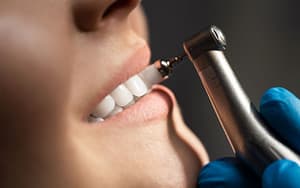 dental-hygienists-help-keep-teeth-clean-and-plaque-free