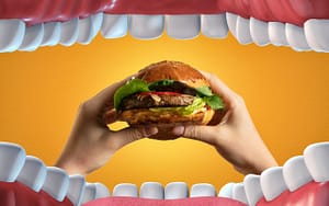 A person displaying their teeth before and after braces, while holding a hamburger.