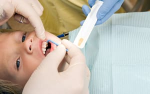 dental-hygienists-offer-preventative-care-like-fluoride-treatments-or-dental-sealants