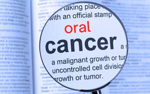what-is-oral-cancer
