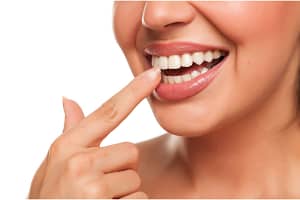 woman pointing to straight teeth