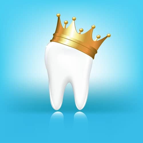 Same Day Dental Crowns